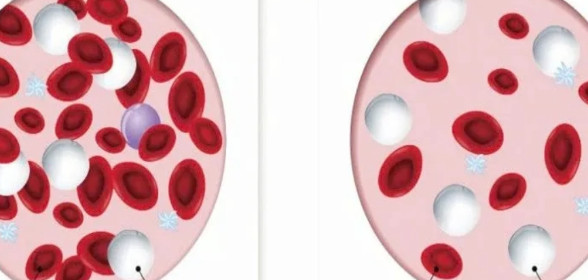 Thai nhi bị thiếu máu