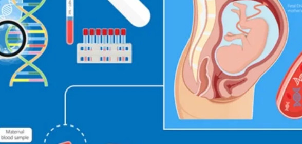 Sàng lọc trước sinh