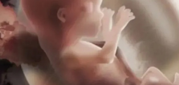 Thai chậm tăng trưởng trong tử cung